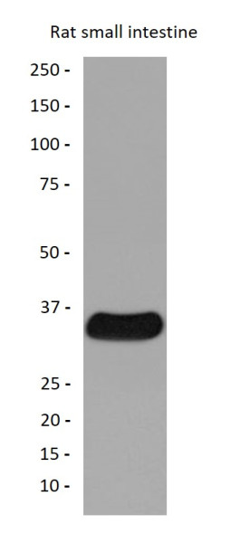 Anti-Galectin 4