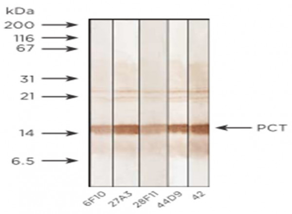 Anti-Procalcitonin, clone 38F11