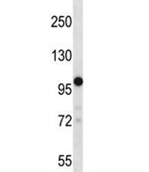 Anti-TRPM4