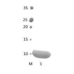 InaDl_10 PDZ Domain