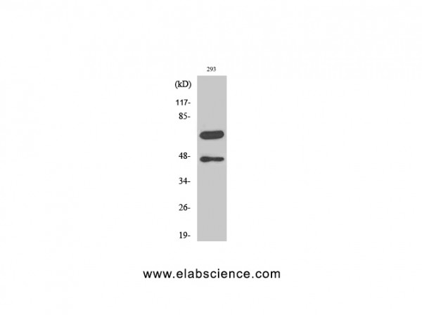 Anti-Cleaved-Caspase-8 (D384)