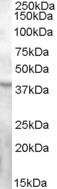 Anti-GPR119, C-terminal