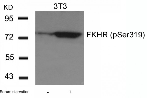 Anti-phospho-FKHR (Ser319)
