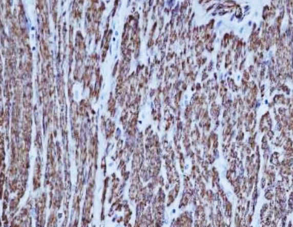 Anti-MYH11 / SMMHC, clone SQab20185