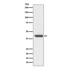 Anti-Doublecortin / DBCN / DCX, clone AOAD-4