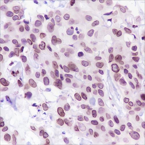 Anti-Recombinant FBXW7, clone A220