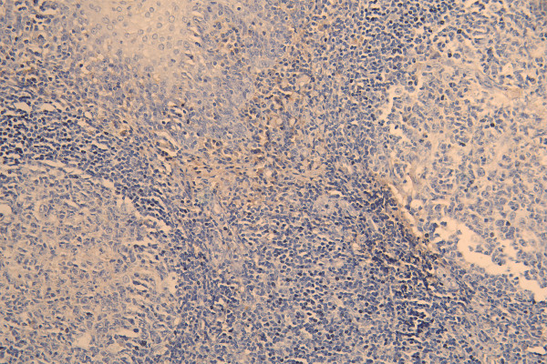 Anti-TNFRSF4, recombinant clone 7F4