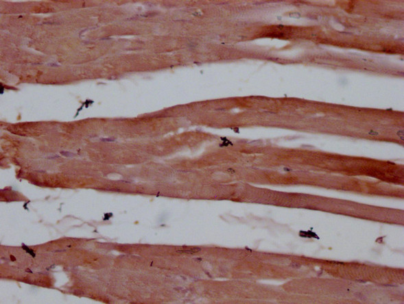 Anti-ACTC1/ACTA1/ACTG2 Monoclonal