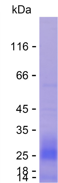 Recombinant Human AMHR2 Protein