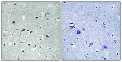 Anti-Phospho-LATS1/LATS2 (Thr1079/1041)