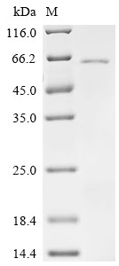 Protein mono-ADP-ribosyltransferase PARP10 (PARP10), partial, human, recombinant