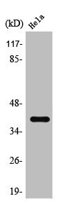 Anti-HTR5A