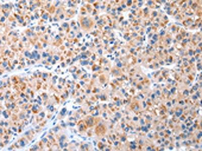Anti-CXCR4