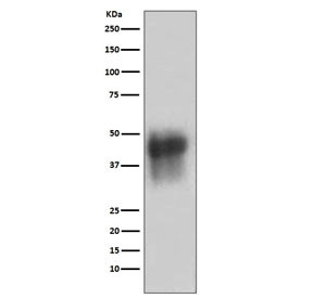 Anti-CD46, clone AEI-3