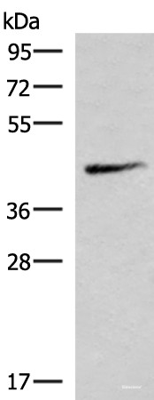 Anti-SMPD2