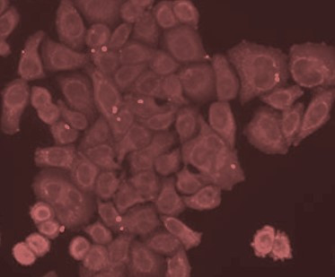 Anti-DMP1