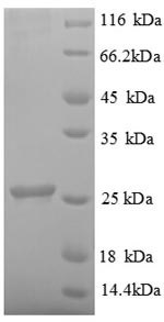 Ubiquitin-conjugating enzyme E2 K (UBE2K), human, recombinant