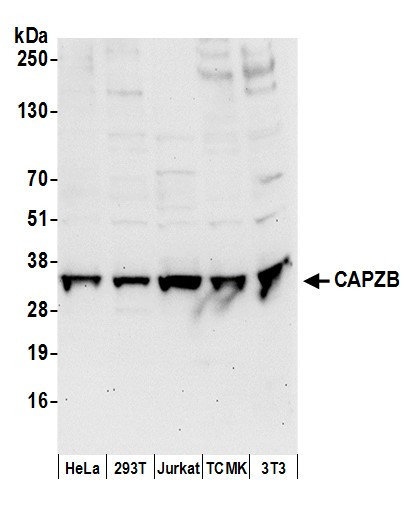 Anti-CAPZB