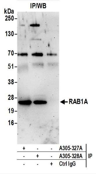 Anti-RAB1A