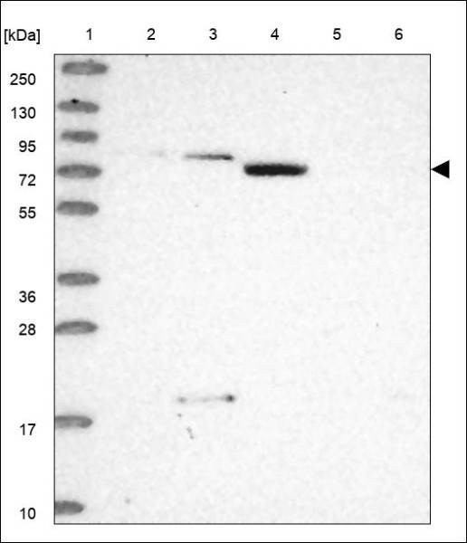 Anti-SLC26A5