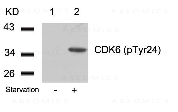 Anti-CDK6 (phospho-Tyr24)