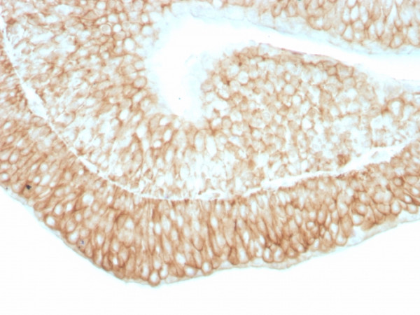 Anti-CD59 / Complement Regulatory Protein / Protectin, clone 193-27
