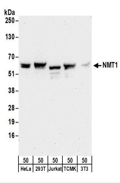 Anti-NMT1