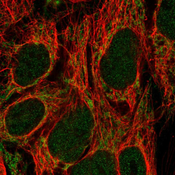 Anti-CDK5RAP1