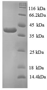 TRAF family member-associated NF-kappa-B activator (TANK), partial, human, recombinant