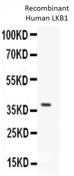 Anti-STK11 / LKB1