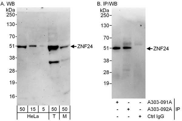 Anti-ZNF24