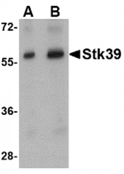 Anti-STK39 / SPAK