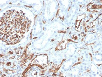 Anti-CD31 / PECAM-1 (Endothelial Cell Marker) Monoclonal Antibody (Clone: PECAM1/3528)