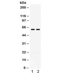 Anti-TCP1 gamma / CCT3