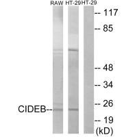 Anti-CIDEB