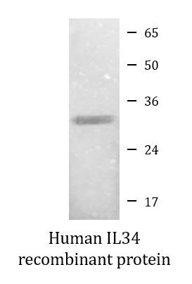 Human IL34 recombinant protein (Active)