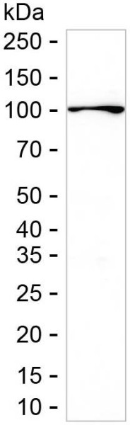 Anti-PI 3 Kinase p100