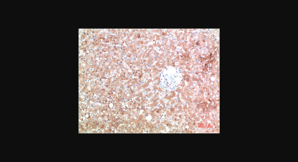 Anti-TTR (5A11), monoclonal