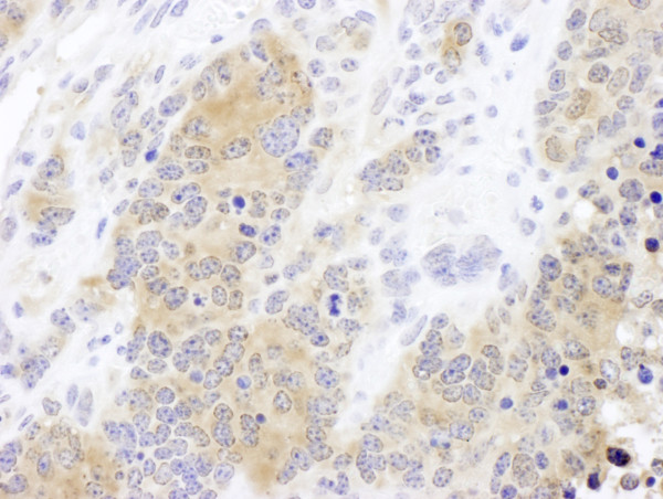 Anti-CCT2