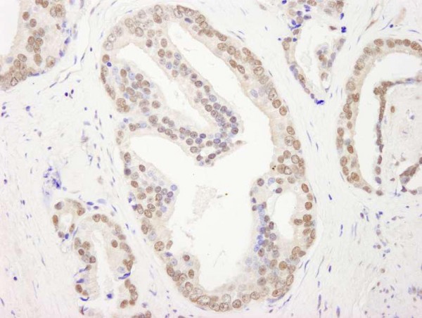 Anti-RBM26 (IHC)