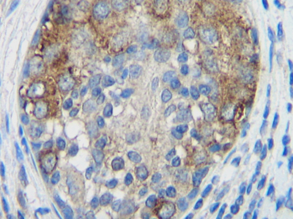 Anti-MCP-1 / CCL2, clone 2.2-4H5-1A11