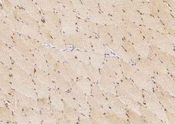 Anti-BMI1 Monoclonal Recombinant Antibody