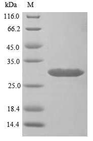 Sclerostin domain-containing protein 1 (Sostdc1), mouse, recombinant