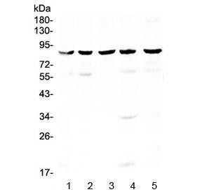 Anti-NOX4 / NADPH oxidase 4