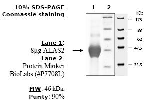 ALAS2, active human recombinant protein