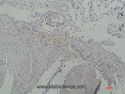 Anti-Galectin 3, clone 8D7