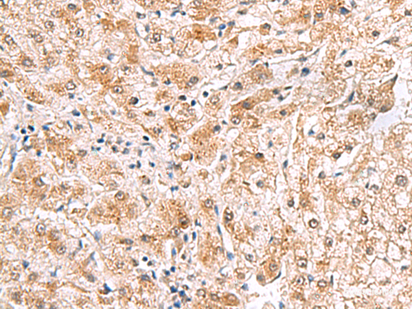Anti-PDCL2