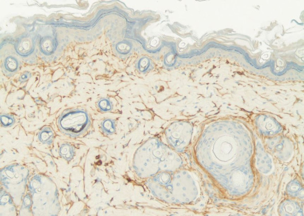 Anti-Elastin