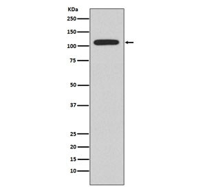 Anti-NFAT2 / NFATC1, clone ABDA-14