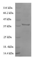 Malate dehydrogenase (mdh), Escherichia coli, recombinant